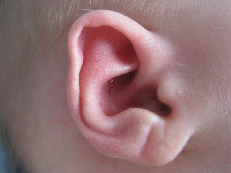 Perfect ear Perfect ear